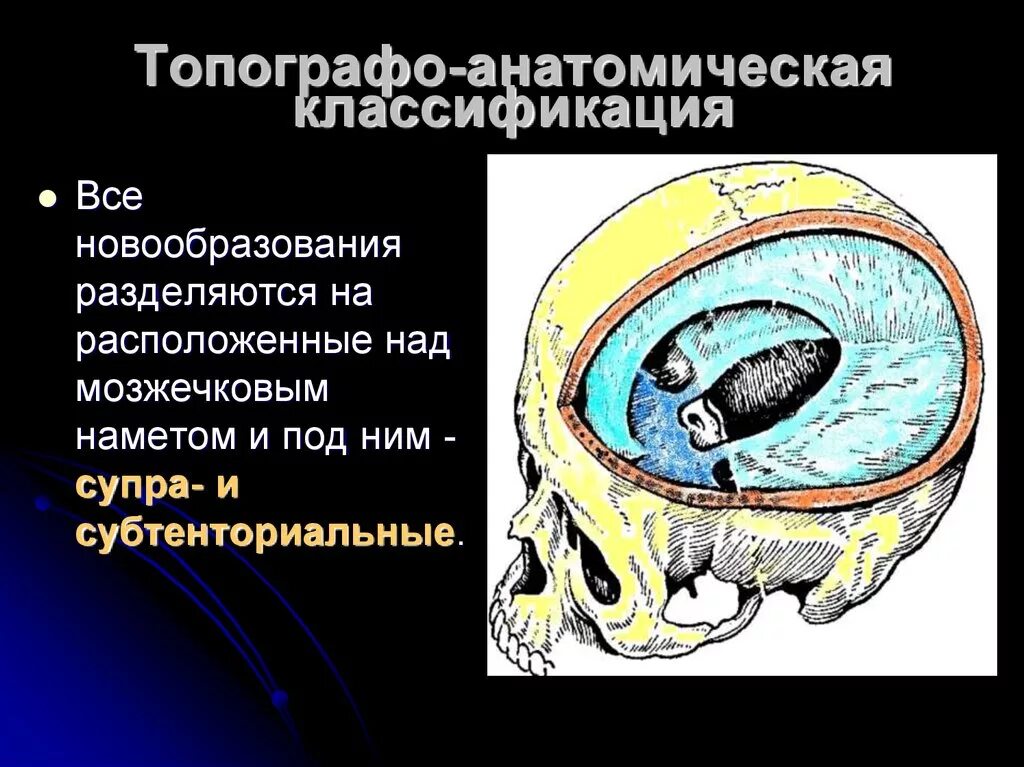 Супратенториальные структуры что это. Супратенториальные структуры что это