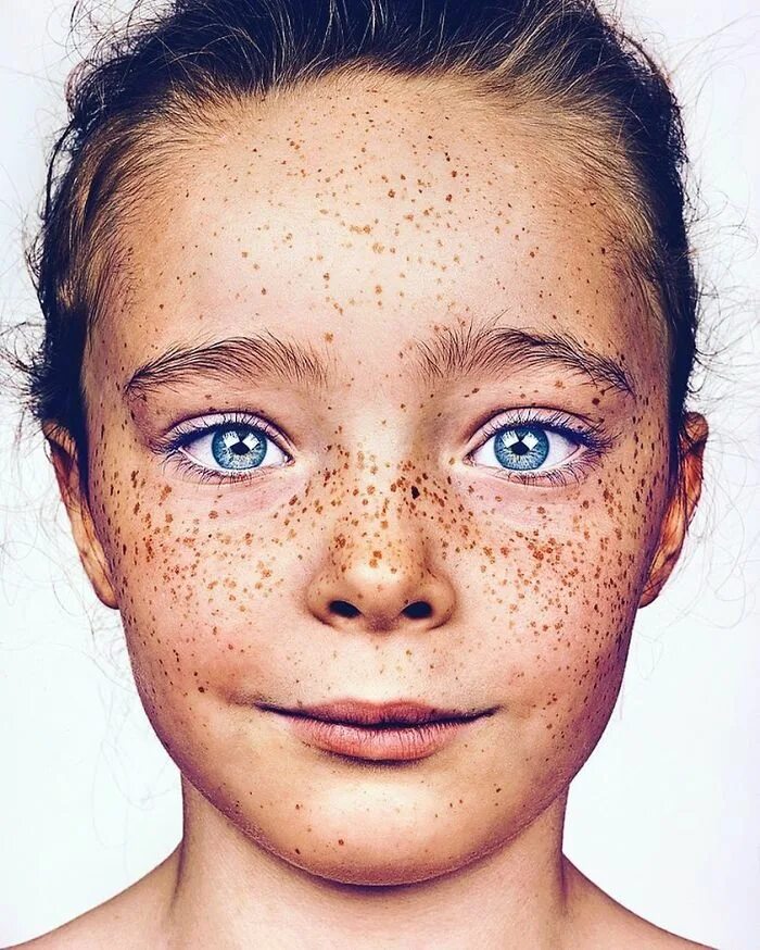 Freckles перевод. Веснушки на лице. Портрет человека.
