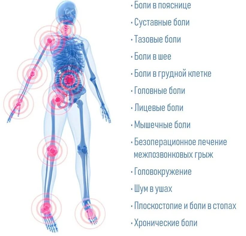 Боль неврология. Неврологические боли. Как болит неврология. Неврология боли l3. Неврологические боли в ногах