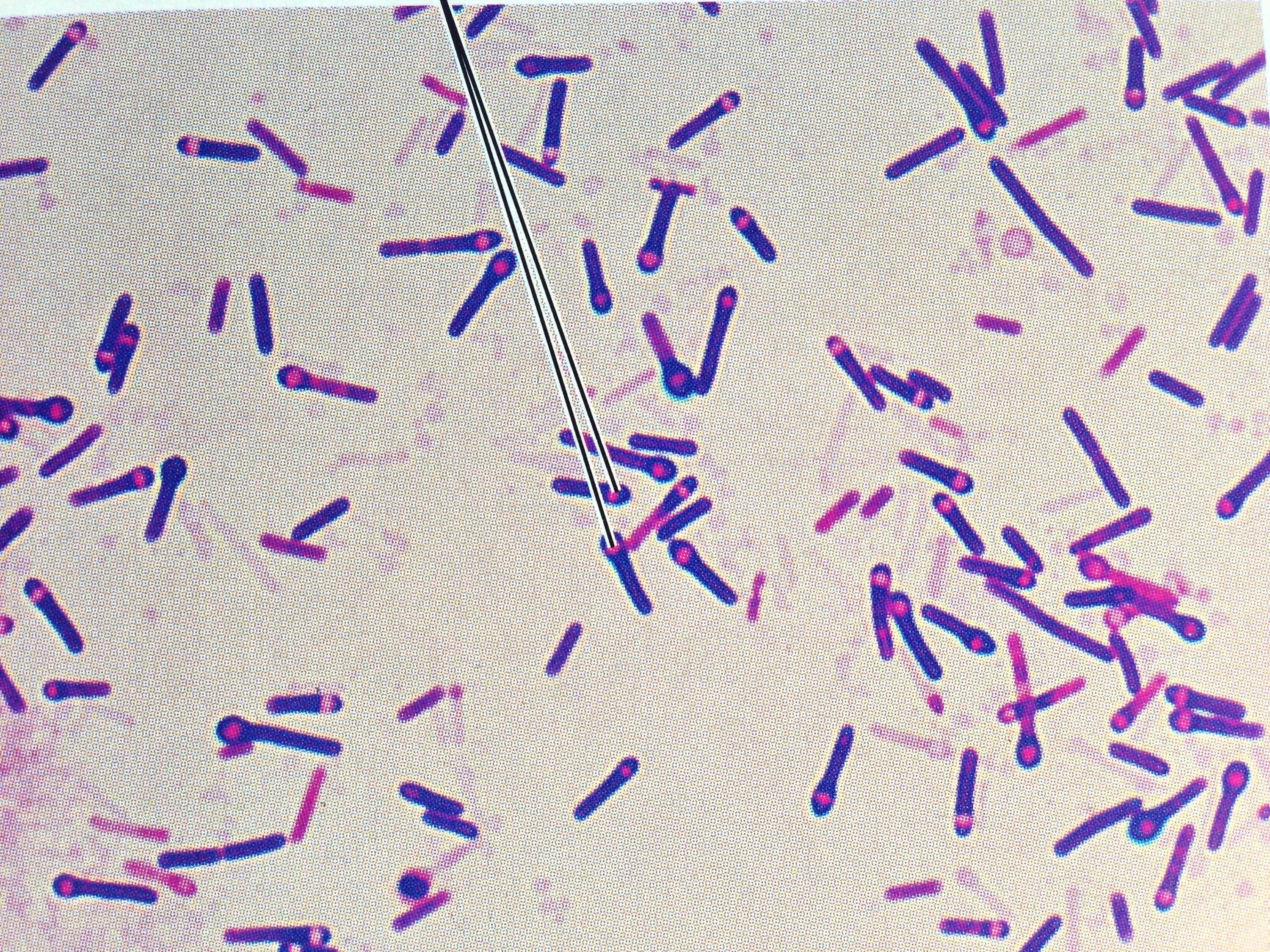 Clostridium spp. Грамположительные бациллы. Клостридии.. Грамположительные палочки. Коринебактерии.. Коринебактерии дифтерии микробиология.