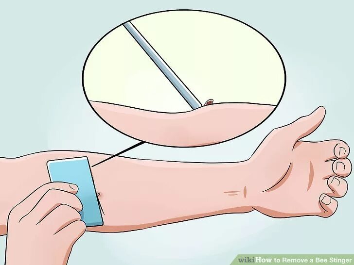 To further remove