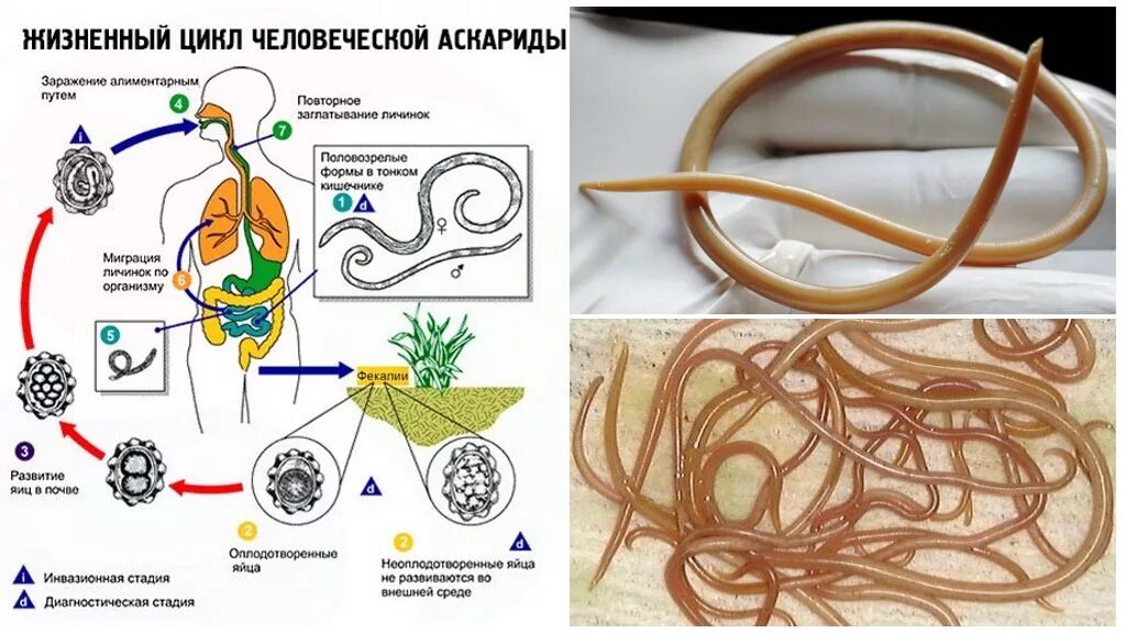Жизненный цикл аскариды. Жизненный цикл аскаридоза схема. Жизненный цикл Ascaris lumbricoides схема. Цикл развития Ascaris lumbricoides. Ascaris lumbricoides жизненный цикл.
