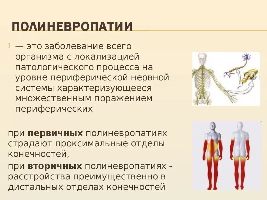 Поражение сенсорных волокон нервов верхних конечностей. Полинейропатии неврология. Симптомы полиневропатии. Болезнь полинейропатия. Нейропатия справа