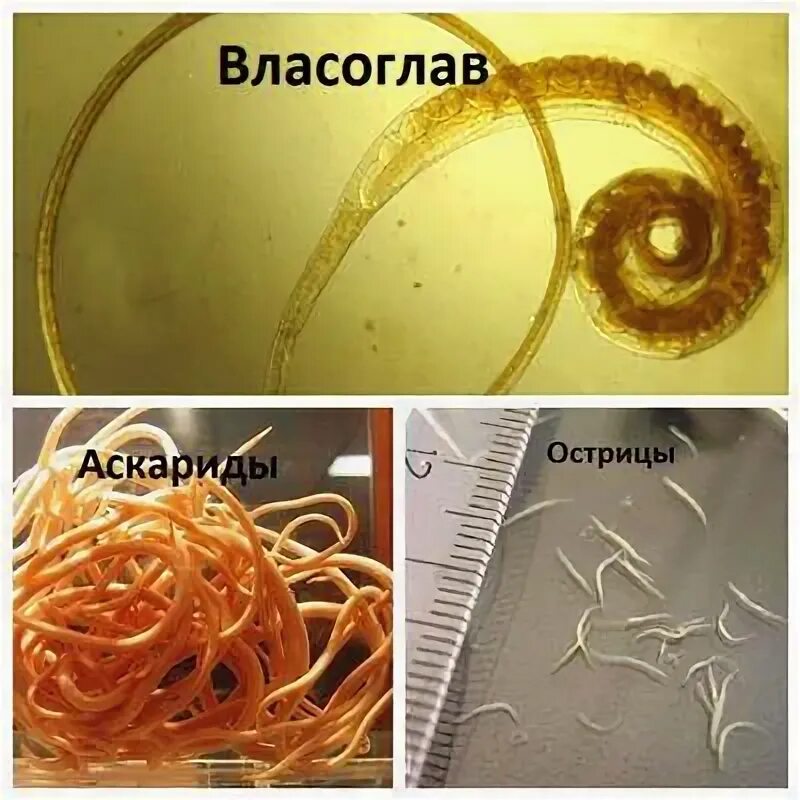 Виды глистов у человека фото и описание