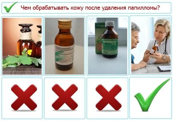 удаление папиллом чем обрабатывать. веррукацид раствор 2г. средство обработки после удаления папилломы. удаление папиллом чем обрабатывать. лекарство для прижигания ран.
