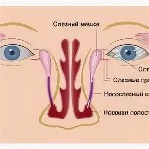 Слезно носовой канал. Непроходимость носослезного канала. Закупорка слезного канала. Непроходимость носослезного канала у новорожденных.