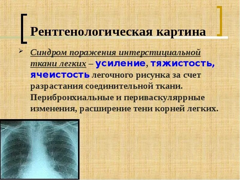 Изменения в легких. Перибронхиальные изменения. перибронхиальные изменения в легких что это. перибронхиальные и периваскулярные изменения в легких что это. перибронхиальные изменения на рентгене.