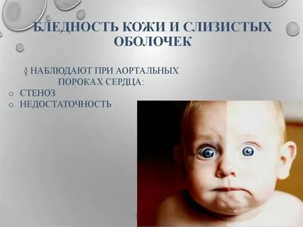 Бледные слизистые