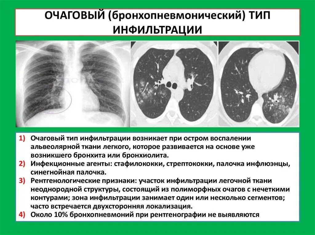 Может быть поражение легких