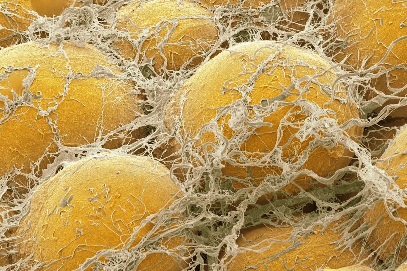 жировые клетки адипоциты. адипоциты жировой ткани. бурая жировая ткань гистология. структура и функции жировой ткани. бурая жировая ткань термогенез.