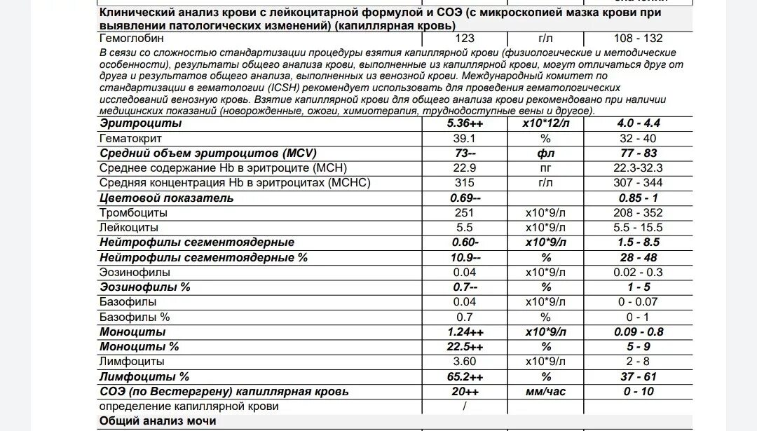 Что показывает общий анализ крови при раке. Анализ крови плазматические клетки норма. Плазматическая клетка в анализе крови. Норма плазматических клеток в крови у детей таблица. Плазматические клетки в общем анализе крови норма.