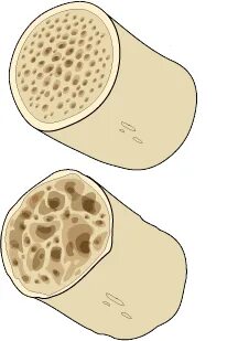 Плотная кость