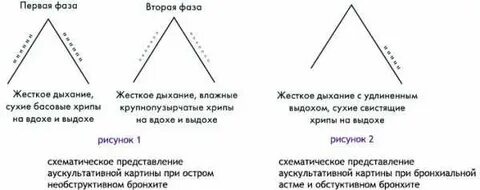Жесткие хрипы