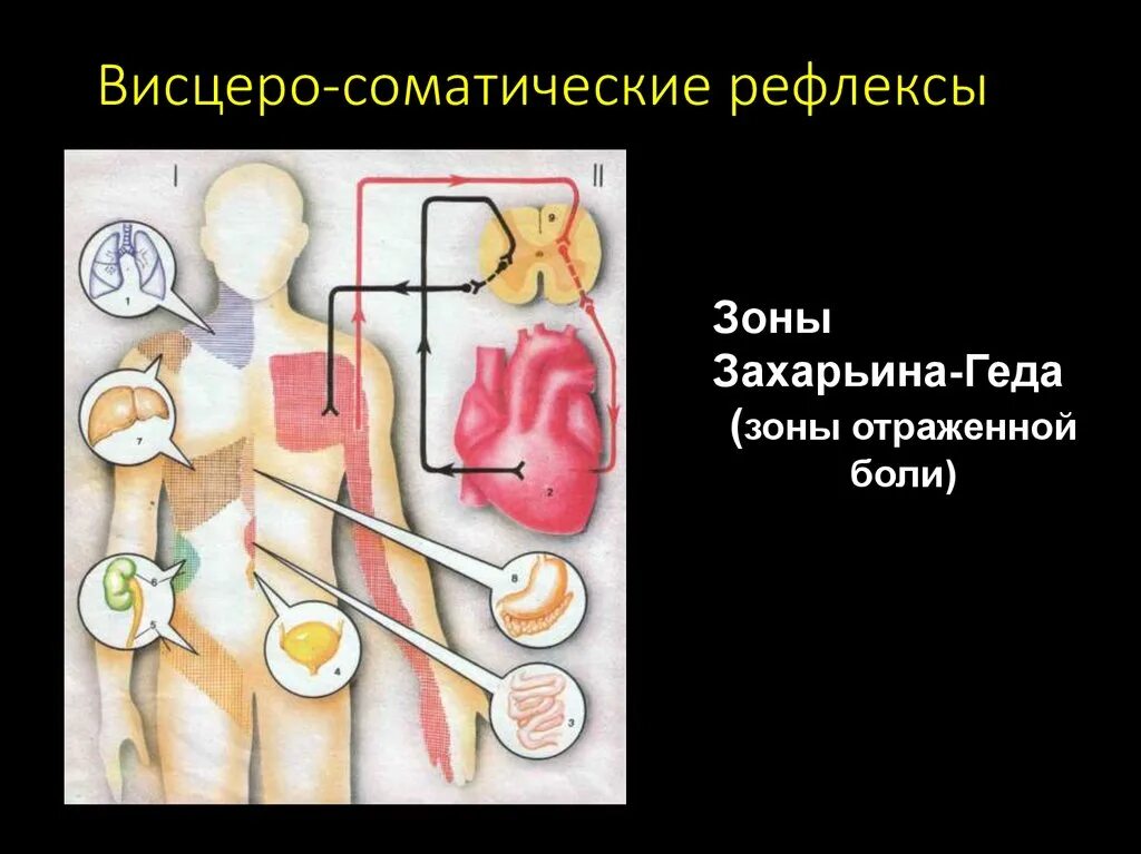 Висцеральный рефлекс. Висцеромоторные рефлексы. Моторно-висцеральные рефлексы. Висцеро соматический рефлекс. Висцеро-висцеральные рефлексы примеры.