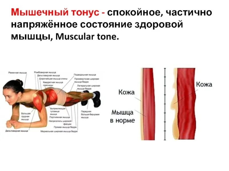 Тонус поясницы. Мышечный гипертонус. Тонус мышц. Мышечный тонус гипертонус. Нормальный тонус мышц.