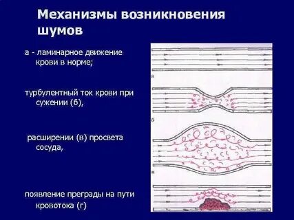 Опишите механизм возникновения