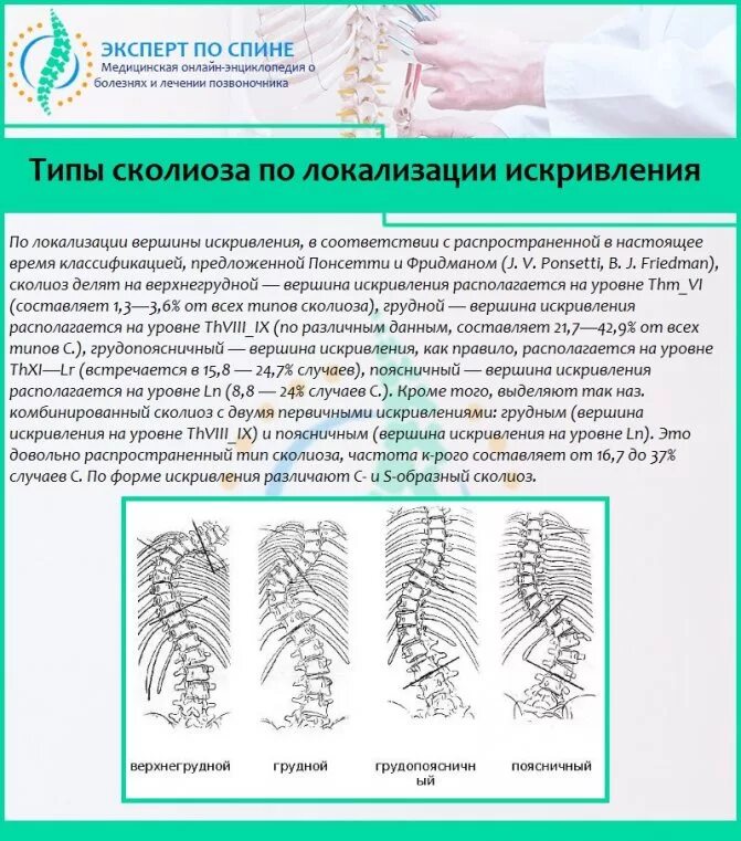 Сколиоз 4 степени инвалидность. Сколиоз позвоночника классификация. сколиоз позвоночника 3 степени инвалидность. комбинированный сколиоз. типы сколиозов по локализации.