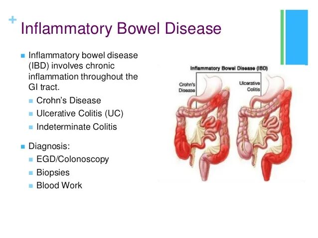Bowel disease. Bowel disease. Синдром мальабсорбции в кишечнике. Bowel disease. Жкт человека.