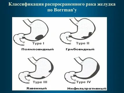 Классификация желудков