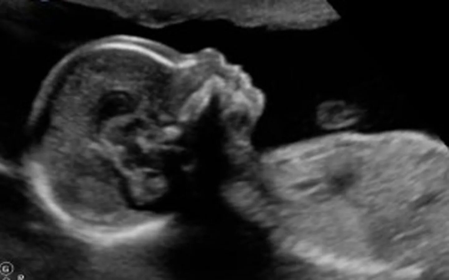 Снимок УЗИ 32 недели беременности. УЗИ 32-33 недели беременности. УЗИ плода на 33 неделе беременности.