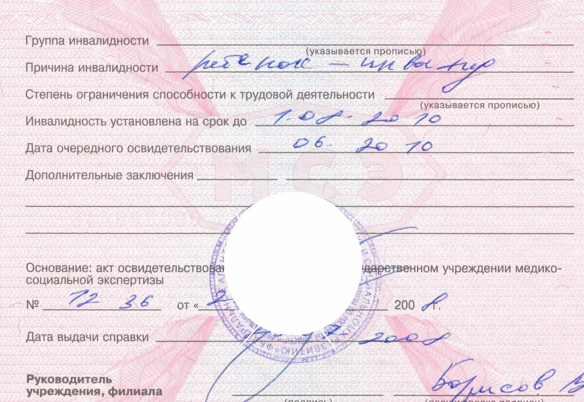 Инвалидность по группам. Инвалидность группы инвалидности. 1 Группа инвалидности. 3 Группа инвалидности. Изменение группы инвалидности