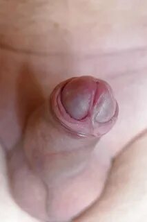 Slideshow edging frenulum.