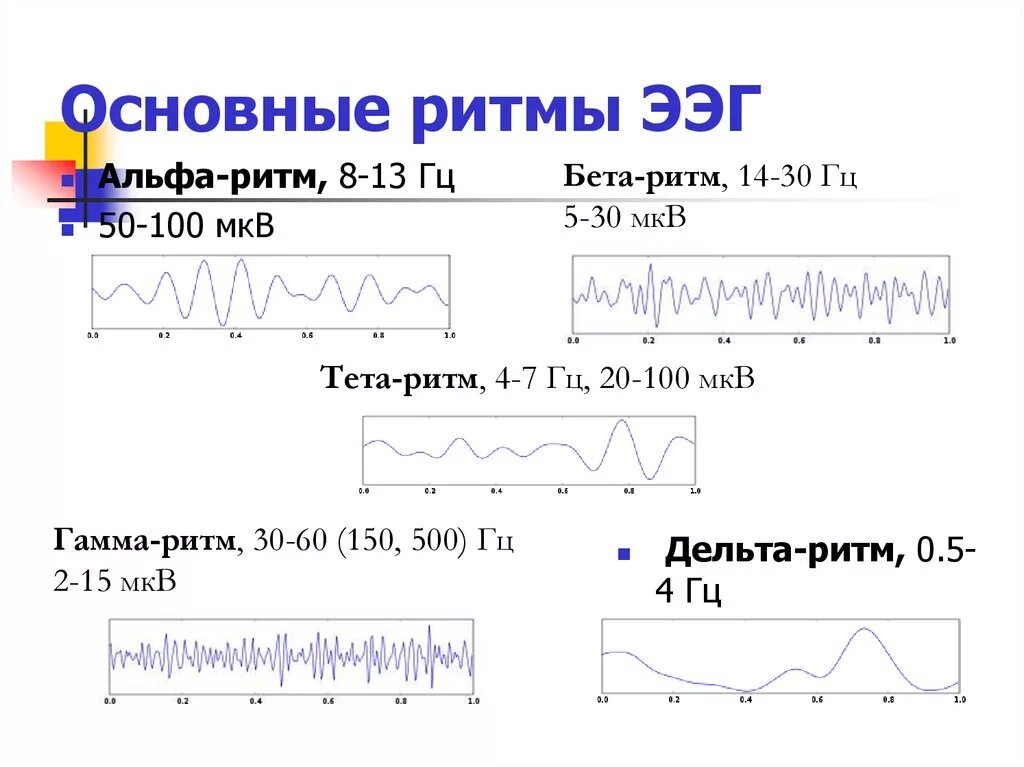 Ээг дельта. Альфа и бета ритмы на ЭЭГ. ЭЭГ бета тета Дельта ритмы. Альфа ритм бета ритм тета ритм Дельта ритм ЭЭГ. Основные характеристики ЭЭГ колебаний.