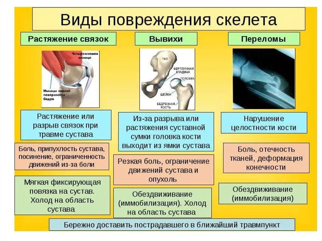 Травмы симптомы первая помощь. Памятка при переломе вывихе. Оказание первой помощи при вывихах и ушибах. Оказание первой помощи при переломах и вывихах. Таблица на тему травмы.