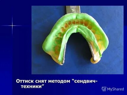 Виды оттисков