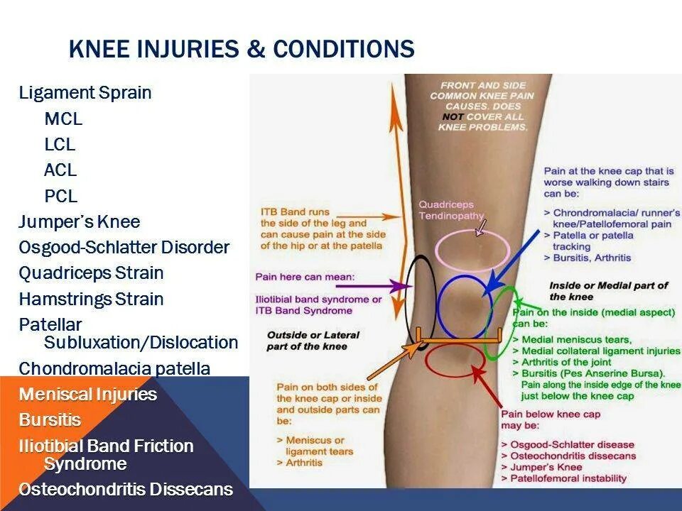 Болит под коленом что это может быть. Пульсирующая боль в колене сбоку с внутренней стороны. Болит нога в области колена сбоку внутри. Болит колено сбоку с внутренней стороны. Боль в ноге под коленом сбоку с внутренней стороны.