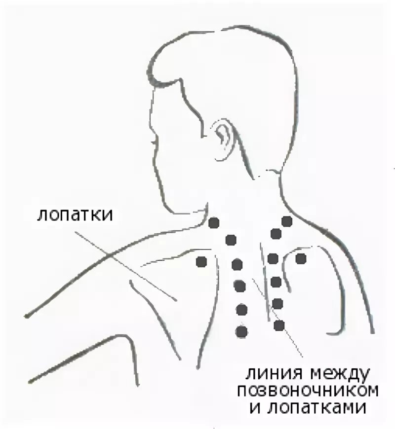 Точка тань-чжун расположение. Подостная мышца триггерные точки. Болит спина при сведении лопаток. Триггерные точки на спине схема. Триггерные точки передней зубчатой мышцы.