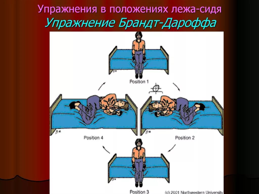 Упражнения брандта при головокружении. Брандта-Дароффа упражнение. Вестибулярная гимнастика Брандта-Дароффа. Упражнениебранта Дароффа. Упражнения Гранта дораффа.