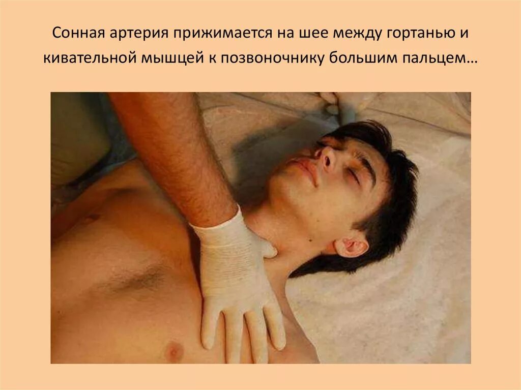 атеросклероз сосудов сонных артерий. где находится сонная артерия на шее фото. расположение наружной сонной артерии. где расположена сонная артерия. где находится сонная артерия у человека на шее фото.