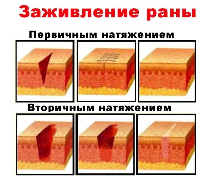 Сколько зарастает кожа: найдено 85 картинок