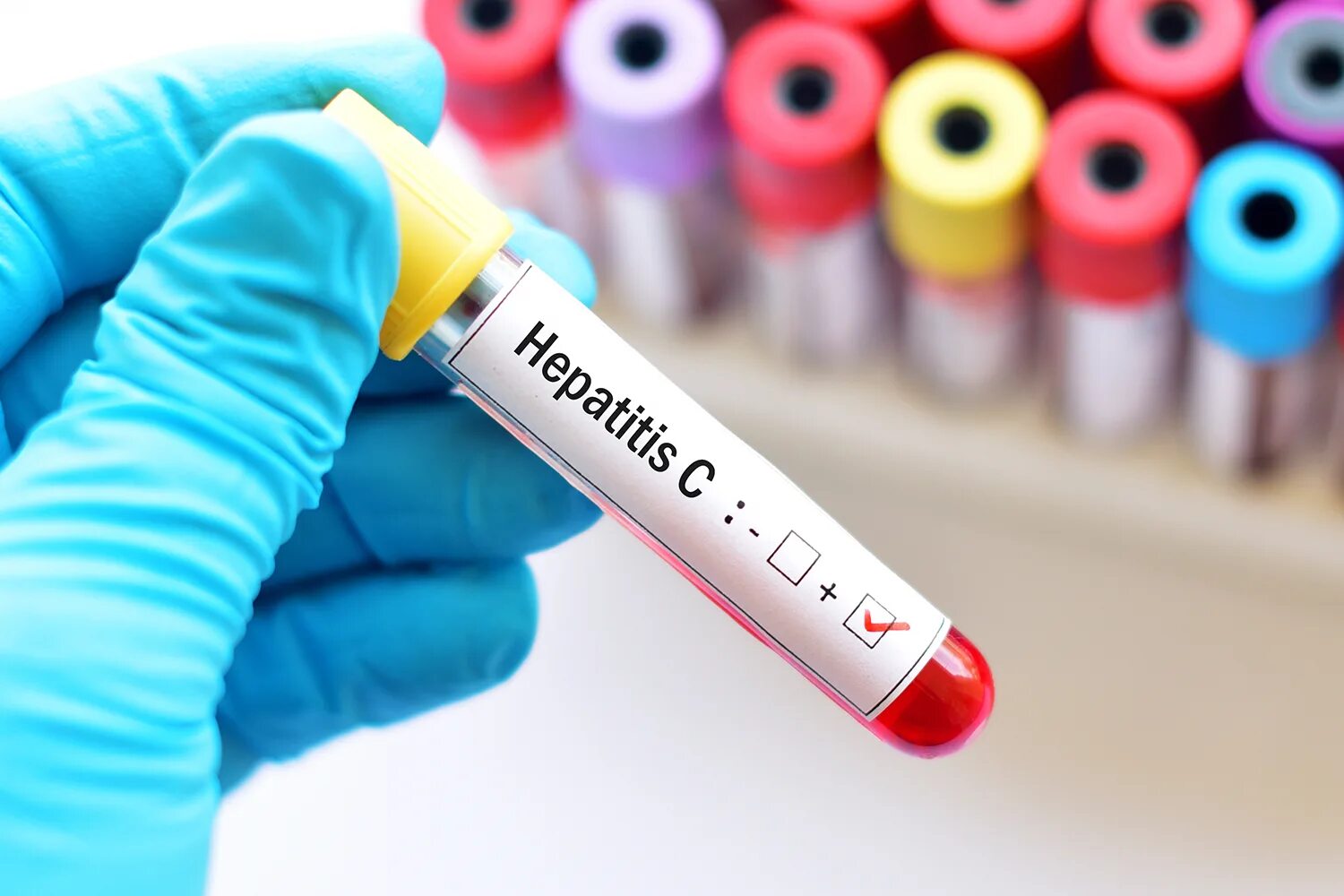 Hcv c