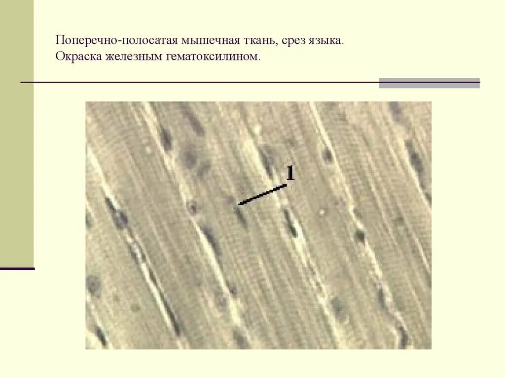 Поперечно полосатая мышечная ткань языка железистый гематоксилин. Скелетная мускулатура гистология. Окраску мышечной ткани. Сердечная мышечная ткань фото. Поперечнополосатая скелетная мышечная ткань гистология.