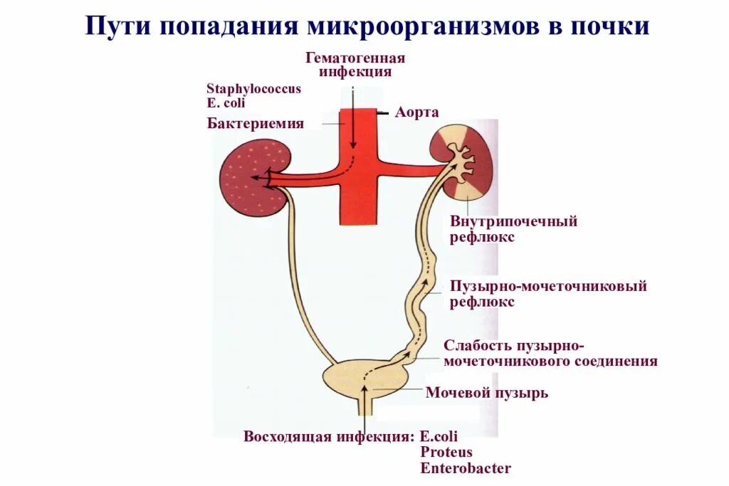 Из мочеточников моча поступает. Пузырно-мочеточникового рефлюкса. Мочевыделительной системы мочевой пузырь. Заболевания мочевыделительной системы пиелонефрит. Заболевания органов мочевыделительной системы у детей.