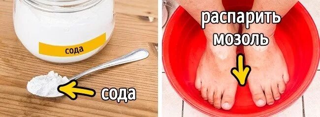 Сода для ног отзывы. Мозоли и натоптыши на ногах способы избавления.