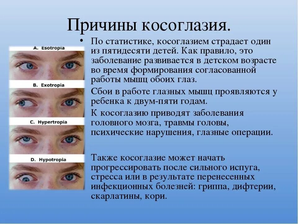 Острота зрения правый глаз левый глаз. Косоглазие причины. Болезни глаз косоглазие. Косоглазие причины возникновения. Косоглазие у детей причины.