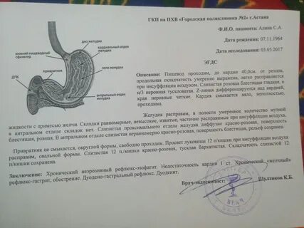 Биопсия 12 перстной кишки