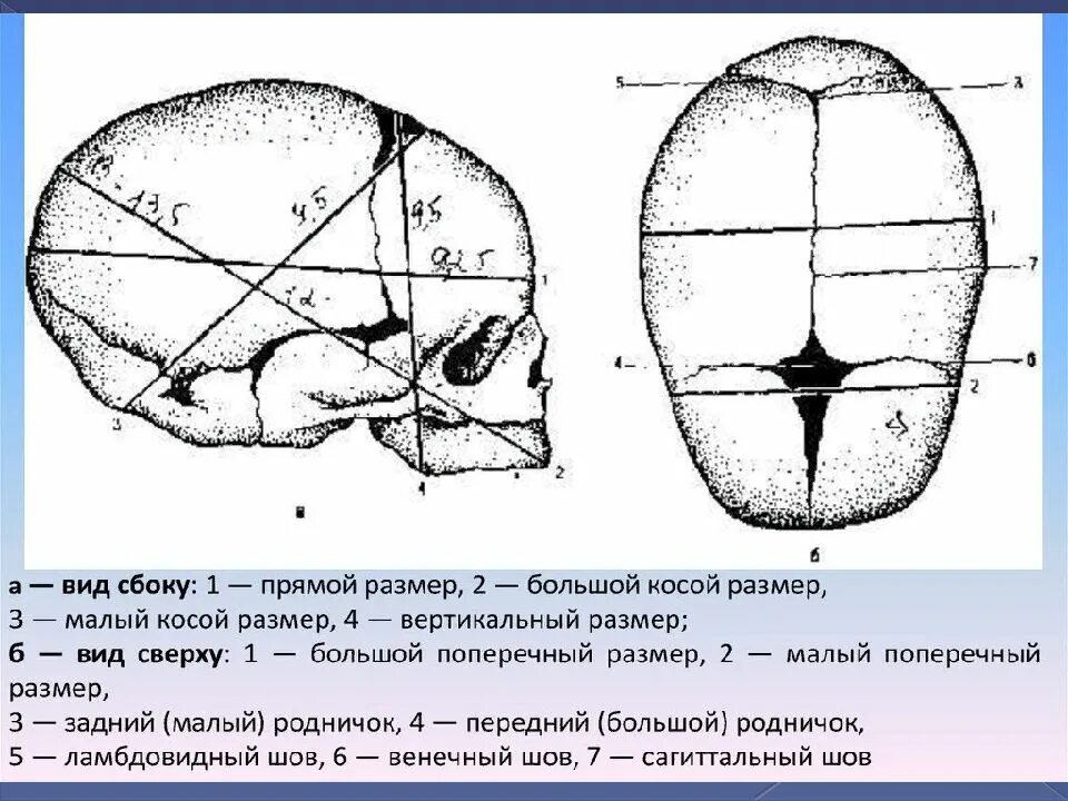Малый сегмент плода. Размеры головки плода. малый косой размер головки плода. малый поперечный размер головки. большой поперечный размер головки.