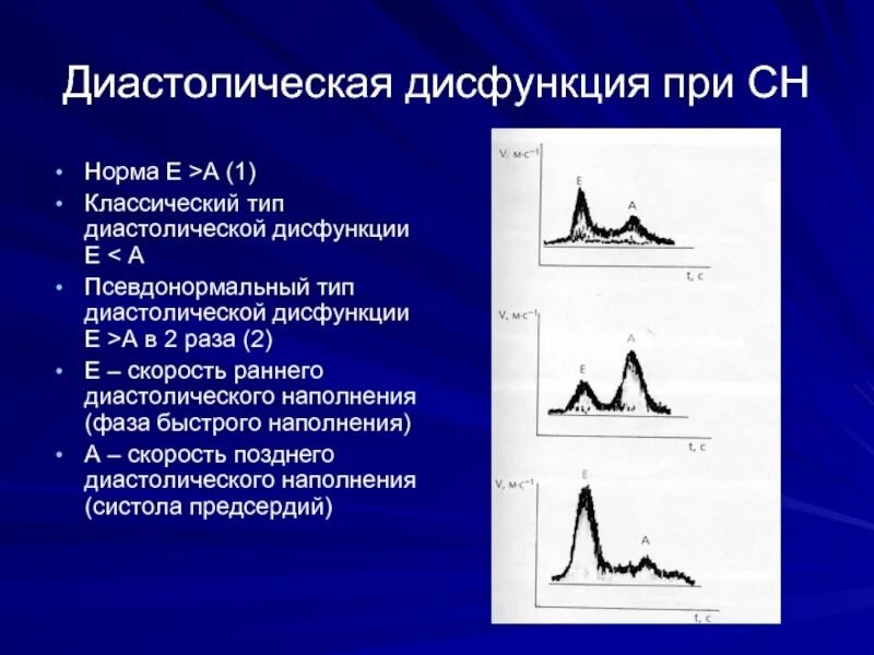 Нарушение функции левого желудочка. Диастолическая функция лж. диастолическая дисфункция левого желудочка. типы наполнения левого желудочка. диастолическая дисфункция на эхокг.