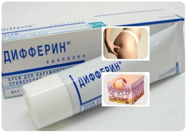 Кожа без целлюлита. Самомассаж ягодиц. Целлюлит и растяжки на попе. Как избавиться от прыщей на ягодицах. Антицеллюлитный массаж.