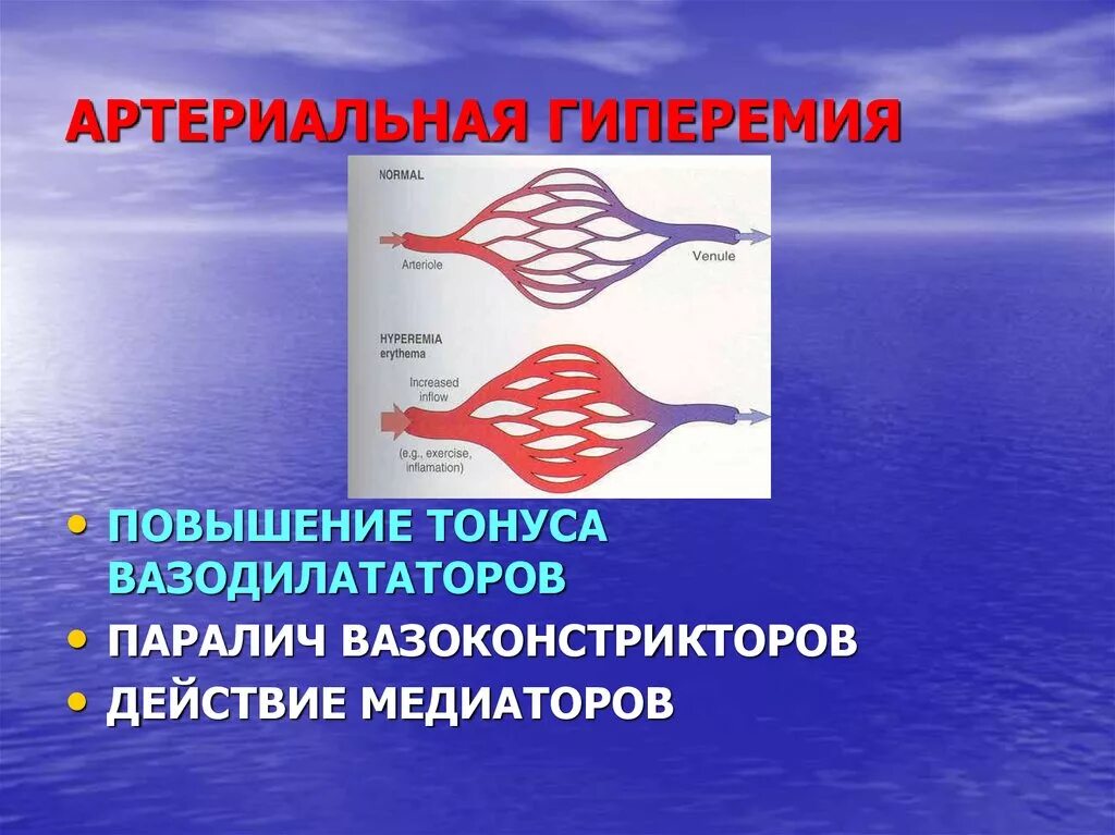 Гиперемия значение. Артериальная гиперемия. артериальная ниперемимия. понятие артериальной гиперемии. артериальная гиксемия.