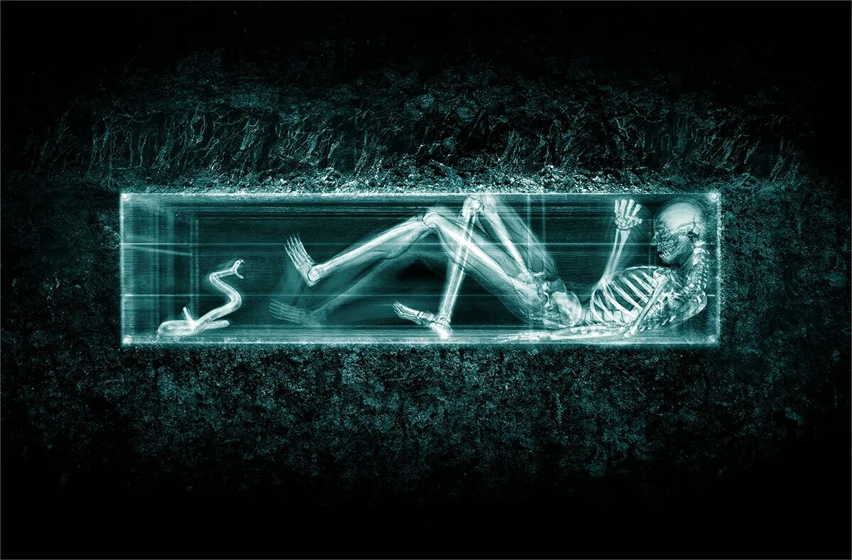 Рентген обои. 3d x ray. Рентген торса. Телевизор x-ray. X ray games