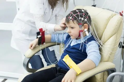 Эпилептолог кто это и что лечит