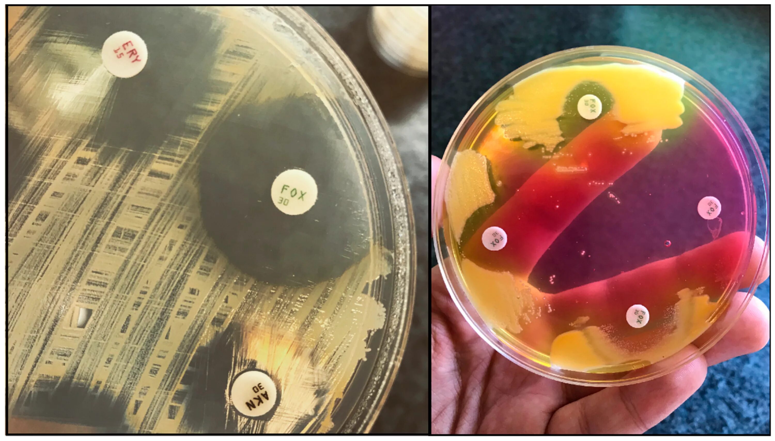 Staphylococcus антибиотики. Staphylococcus aureus цефокситин. антибиотики чувствительные к стафилококку. маннит микробиология. стафилококк гемолитикус.