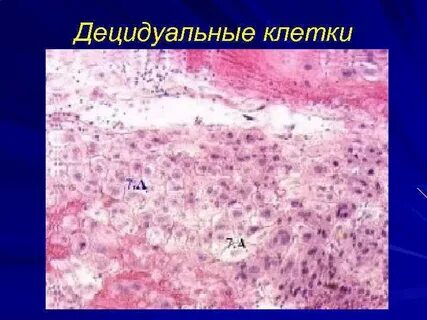 Эндометрий в пременопаузе