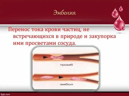 Профилактика масляной эмболии