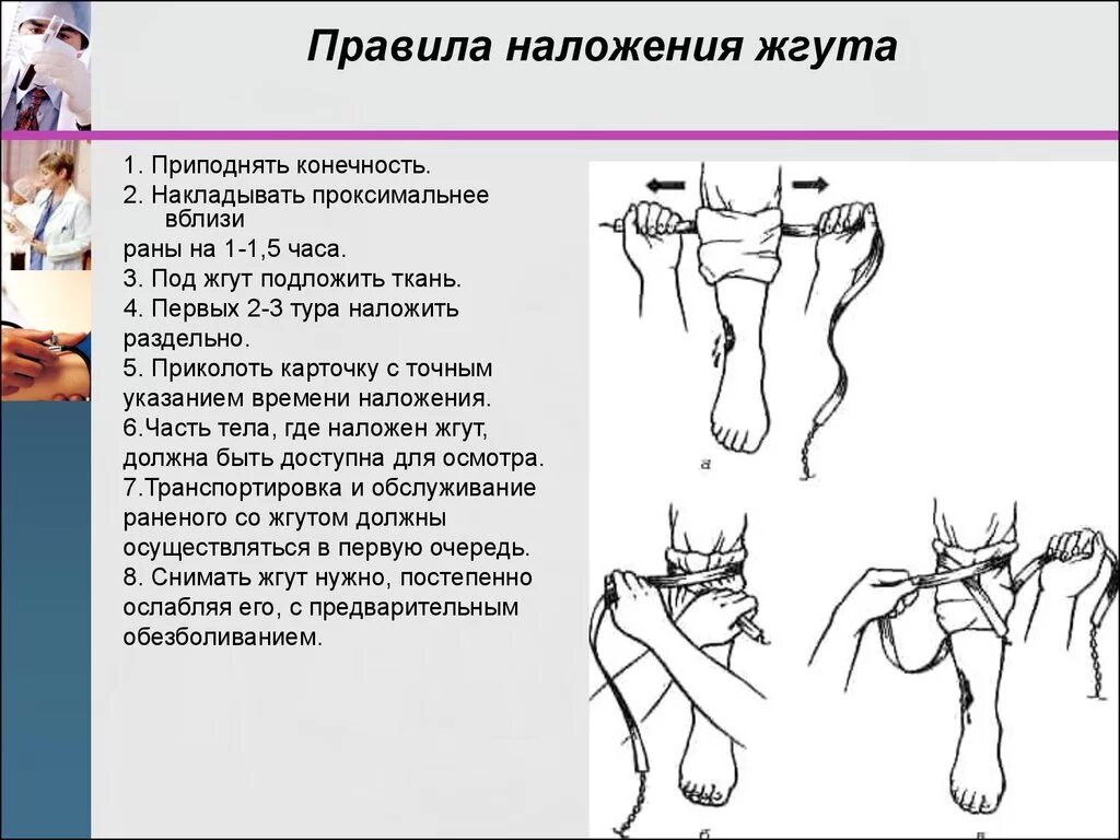 На какое время накладывают артериальный жгут. Правила наложения жгута. Жгут накладывают на конечность. Порядок наложения жгута на конечность. Места наложения кровоостанавливающего жгута.